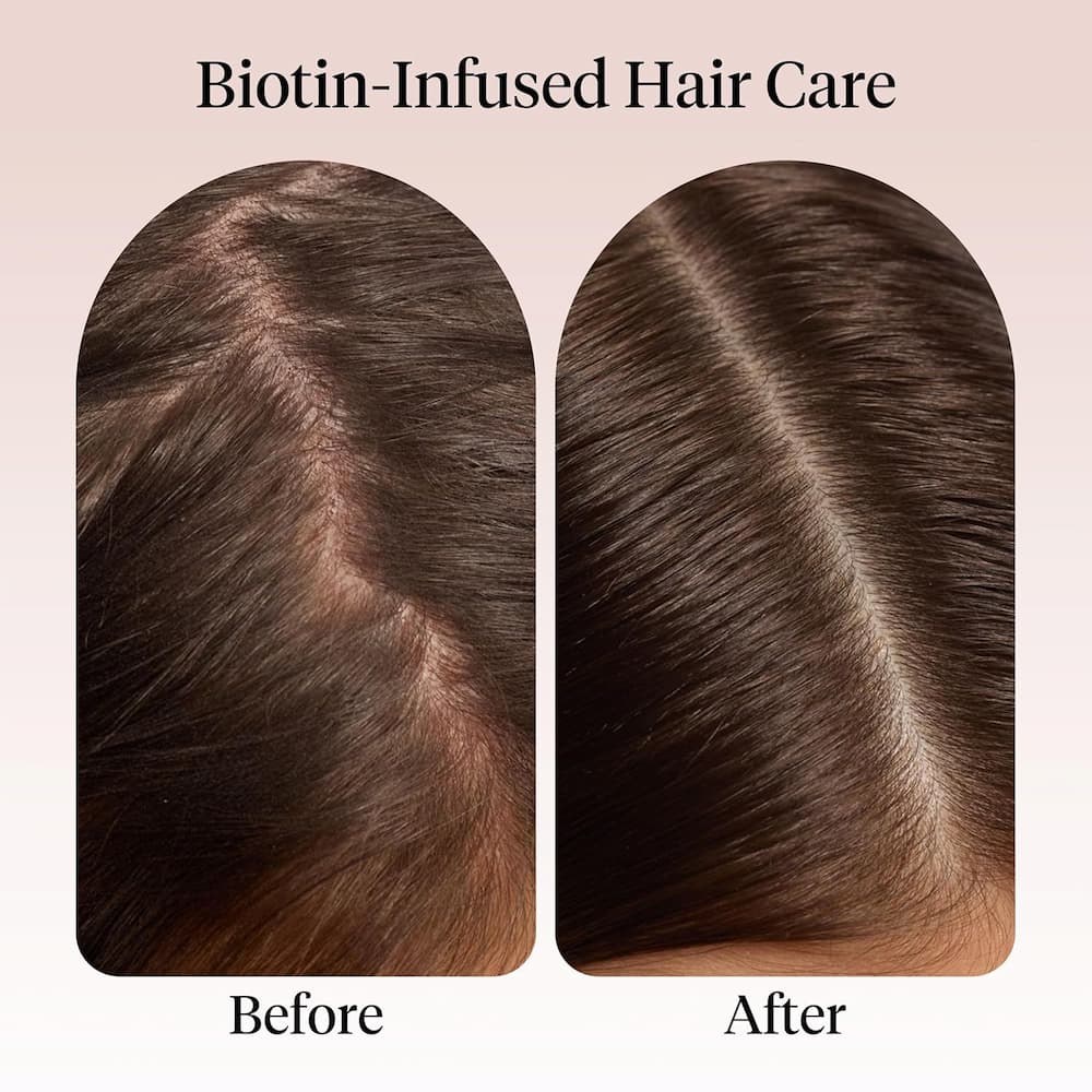 Kitsch Strengthening Rosemary Biotin Scalp Hair Oil Before And After